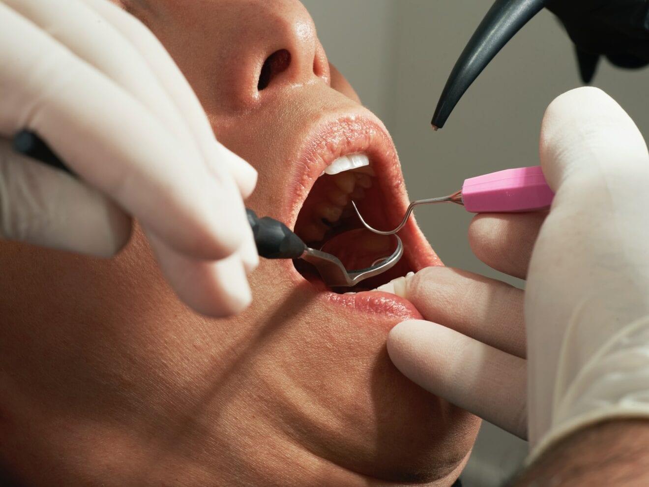 Tandlæge i Vejle: Sådan vælger du din tandlæge