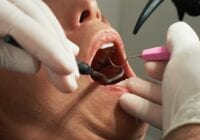 Det er anbefalet at gå til tandlæge mindst en gang om året til et regelmæssigt tandtjek. Pressefoto.